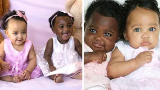Сестры-близнецы родились с разным цветом кожи, посмотрите как они выглядят спустя 6 лет!