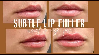 HOW TO GET NATURAL LOOKING LIP FILLER NO KYLIE JENNER LIPS | PRE/POST LIP CARE