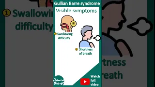 Guillain–Barré syndrome | Acute inflammatory demyelinating polyneuropathy (AIDP) | Pathology USMLE