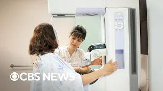 What to know about new breast cancer screening guidelines