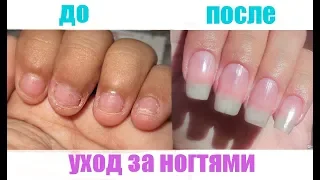 Как ОТРАСТИТЬ ногти за 3 ДНЯ | УХОД за ногтями // УКРЕПЛЕНИЕ ногтей #WithMe #StayHome