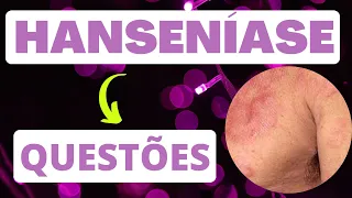 HANSENÍASE - RESOLUÇÃO DE QUESTÕES