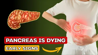 PANCREAS is DYING! 12 Weird Signs of PANCREATIC CANCER