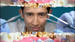 ASMR POV: Dentist Cleans Your ROTTEN Teeth (4K) 🦷