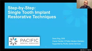 Webinar: Single Tooth Dental Implant Restorations!