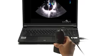 Ultrasound Video Challenge - Cardiography