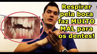 Respirar pela boca faz mal para os dentes? Resposta: SIM, E MUITO!