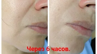 Пептидная косметика вместо уколов красоты.