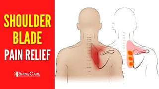 How to Fix Your Shoulder Blade Pain FOR GOOD