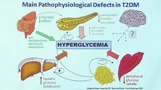 Making Sense of Diabetic Medications