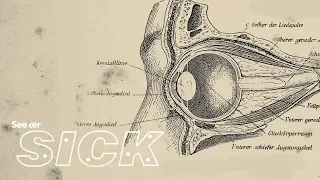 How Does Glaucoma Cause Vision Loss?