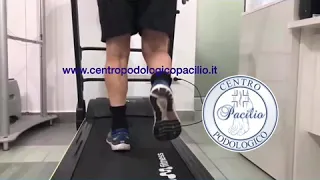 Esame del gesto sportivo del Centro Podologico Pacilio del Prof. Dr. Antonio Pacilio