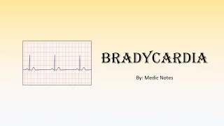 Bradycardia - causes, mechanism and pathophysiology, sign value