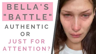 BELLA HADID CRYING ON INSTAGRAM: The Right Way To Open Up On Social Media | Shallon Lester