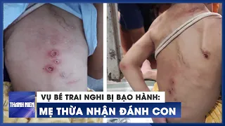 Vụ bé trai nghi bị bạo hành: Người mẹ thừa nhận đánh con