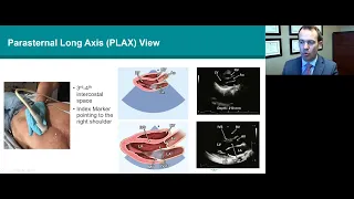 ASE 2021 Normal TTE exam and Doppler echo