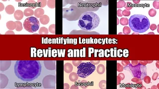 Identifying Leukocytes | Review and Practice