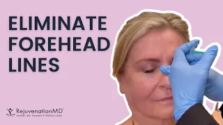 Forehead Lines Removal ⚡ Botox Treatment for Forehead Wrinkles