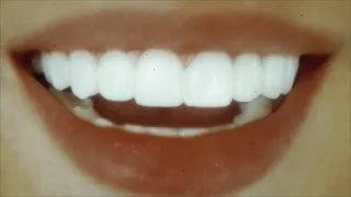 здоровые белоснежные зубы + прикус и десна ✧ саблиминал 432 гц (rus)