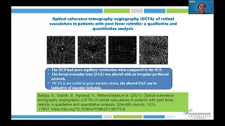 UVEITIS Grand Rounds 7