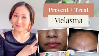 Dermatologist's Guide to Melasma - Preventing + Treating | Dr. Jenny Liu