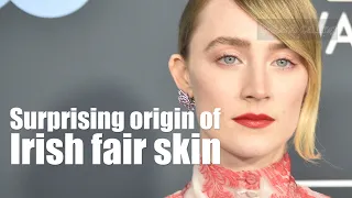 Surprising origin of Irish fair skin (far away from Ireland)