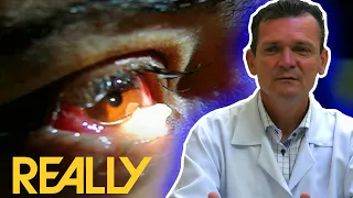 Woman’s Tears Turn Into Crystal IN Her Eyes! | Body Bizarre