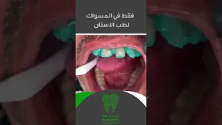 المسواك لطب الأسنان بالمنطقة الغربية( جدة _ مكه _ الطائف)