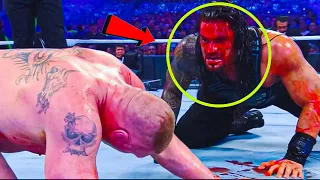 10 WWE INJURIES SO GRUESOME YOU WON’T BELIEVE IT