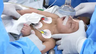 Cute baby waking up after surgery