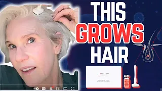 Crazy Fast Hair Growth With GROWTH FACTORS: Reverse Hair Loss Over 50 | Hair Growth Part 3