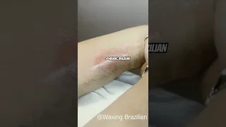 Waxing Brazilian #shorts #remove #waxing #wax