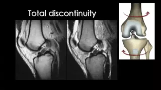 Imaging of the Knee joint  part II   DRE 2   Dr Mamdouh Mahfouz 720p