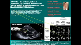 3 Test your skill Echo CASE study Angina with reduced LVEF%