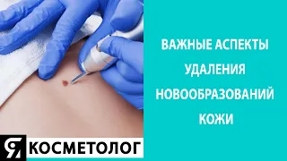 Важные аспекты удаления новообразований кожи