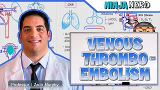 Venous Thromboembolism (DVT, PE) | Clinical Medicine