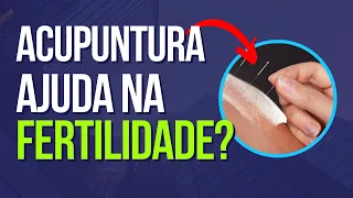 Tudo Sobre Acupuntura e Fertilidade: Uma Explicação Prática