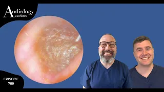 EPIC SKIN PEEL & IMPACTED EAR WAX REMOVAL - EP789