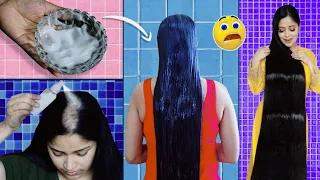 😱I Applied Ricewater on my Bald Scalp & Got Massive Hairgrowth नहाने से पहले एक बार  बालो मे लगा लो