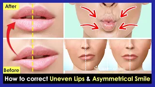 How to correct Uneven Lips, Crooked Lips, Asymmetrical smile by Facial & Lips Exercises.