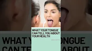 What Your Tongue Can Tell You About Your Health #SHORTS