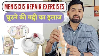 घुटने की गद्दी का इलाज - घुटने की गद्दी की सुजन के लिए एक्सरसाइज | Meniscus injury exercise in hindi