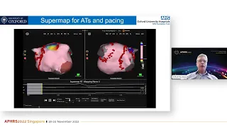 Demystifying Atrial Fibrillation: APHRS Talk from Prof Tim Betts