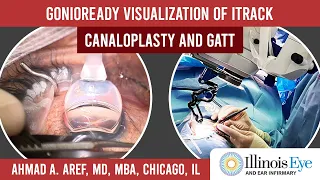 GonioReady Visualization of iTrack ABIC and GATT