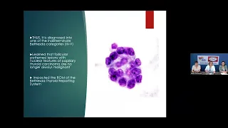 Sistema Bethesda, patología tiroidea  Actualización