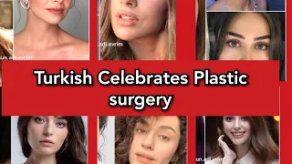 Turkish Celebrates face surgery before and after part 2