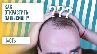 КАК ЗАРАСТИТЬ ЗАЛЫСИНЫ / Как остановить выпадение волос? [Часть 1]