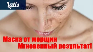 МАСКА-ЧИСТАЯ И СИЯЮЩАЯ КОЖА - МГНОВЕННЫЙ РЕЗУЛЬТАТ. MASK-CLEAN AND SHINING SKIN - INSTANT RESULTS