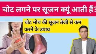 How to Reduce Swelling After an Injury | चोट की सूजन कम करने ले उपाय