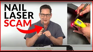 Nail Laser Scams: DIY - Home Fungus Toenail Lasers - Do They Really Work?